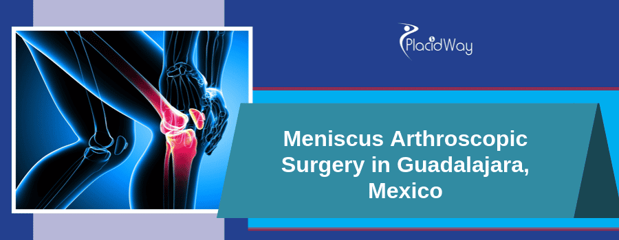 Meniscus Arthroscopic Surgery In Guadalajara, Mexico